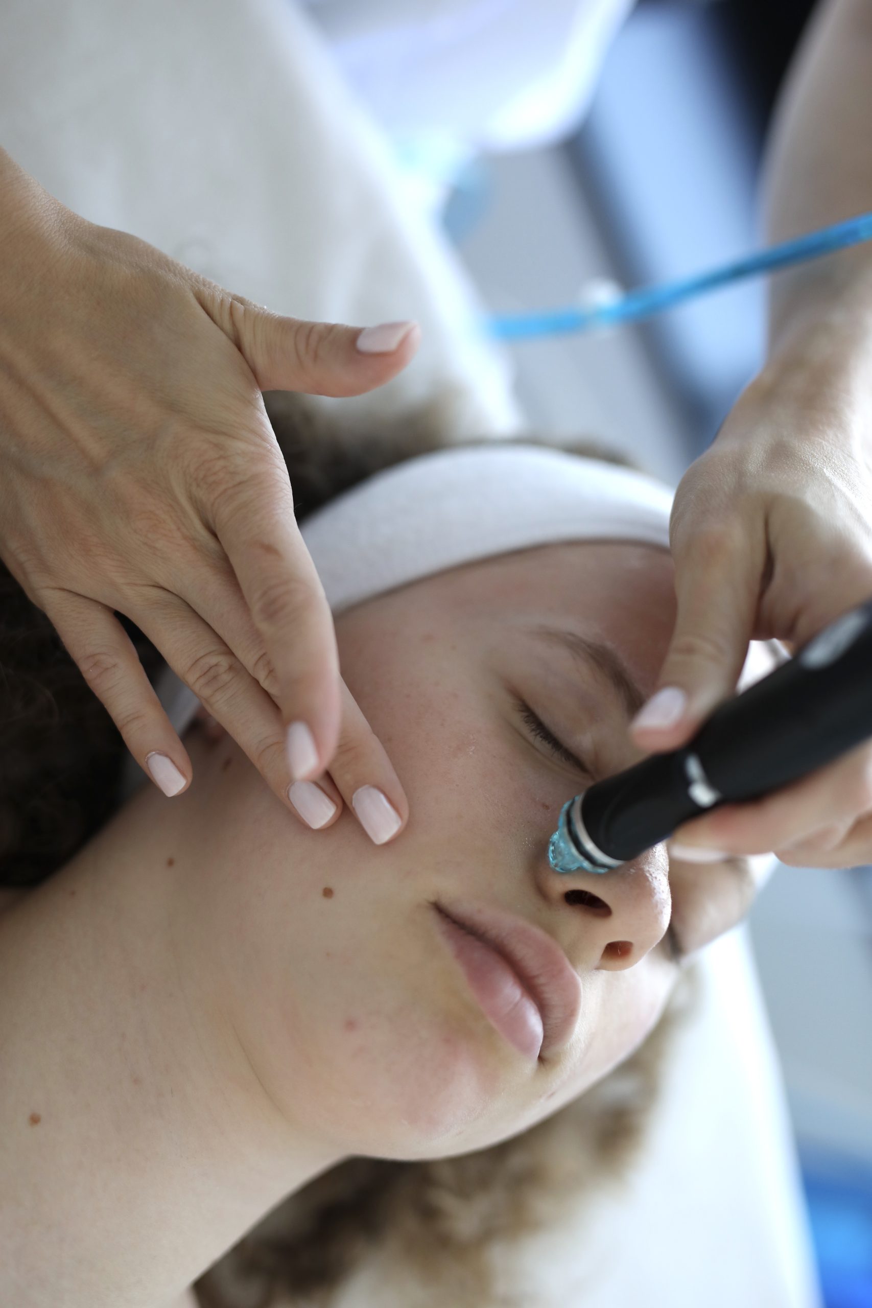 Hydrafacial nega obraza, nega kože