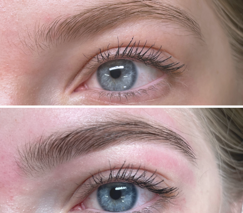 Be good to your skin. You'll wear it everyday for the rest of your life. (5)